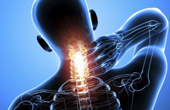 Pain in the neck