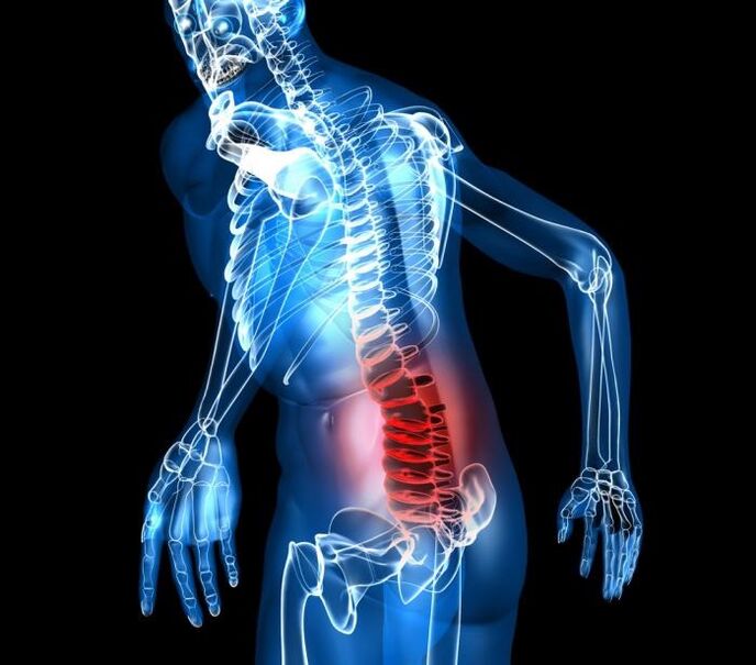 level and level of development of lumbar osteochondrosis