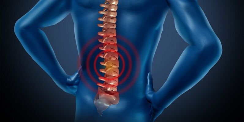 Osteochondrosis of the lumbar area