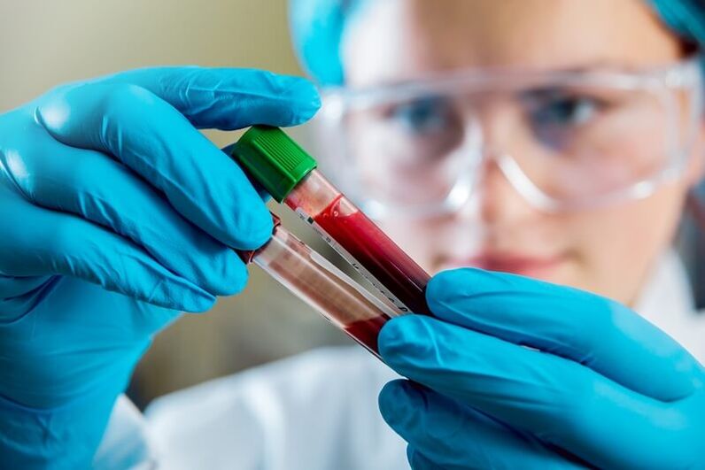 A complete blood test to diagnose low back pain