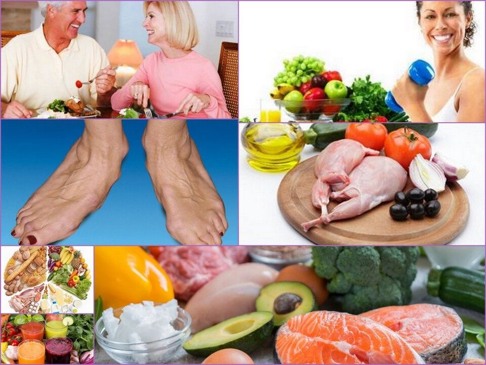 Nutritional principles for those suffering from arthrosis of the knee joint